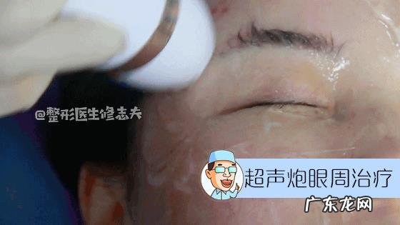 从小笑起来眼角就有皱纹,还很严重,怎么办?