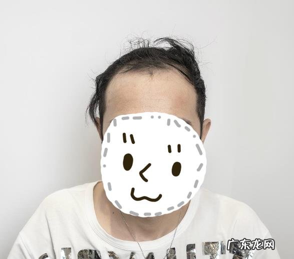 假发戴起来可以有多逼真?