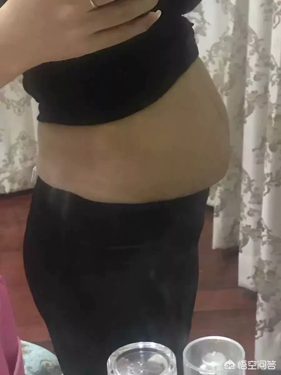 你在产房经历了什么?生完还可以感觉到缝针的痛苦,产后大肚子该怎么瘦回孕前?