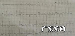 一分钟多少次心率算正常 正常心率是多少