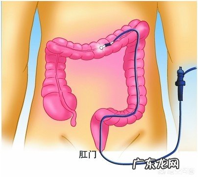 做肠镜对身体有害吗?