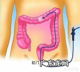 做肠镜对身体有害吗?