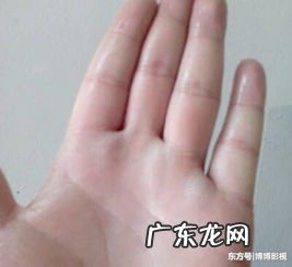 脚心出汗是什么原因男吃什么药 脚心出汗是什么原因女怎么办