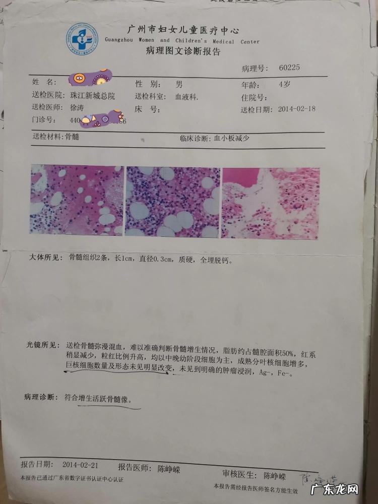 血小板低了怎么办有什么危害 14岁女孩血小板低怎么治疗
