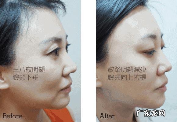 上了年龄的女性,该怎么保养才能更好的改善皮肤呢?