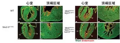 nc患者是什么意思? nc是什么意思