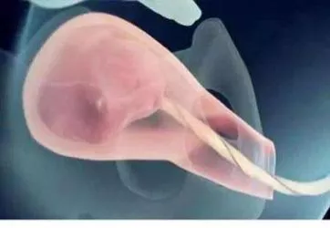 人类给动物杂交到底是好事还是坏事?