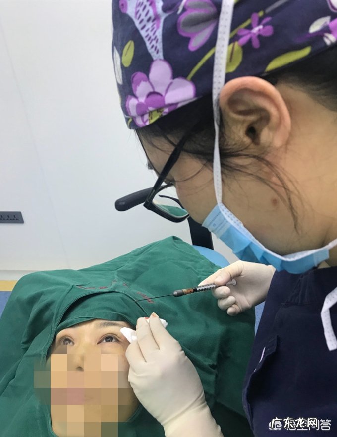 上眼窝凹陷怎么修复?