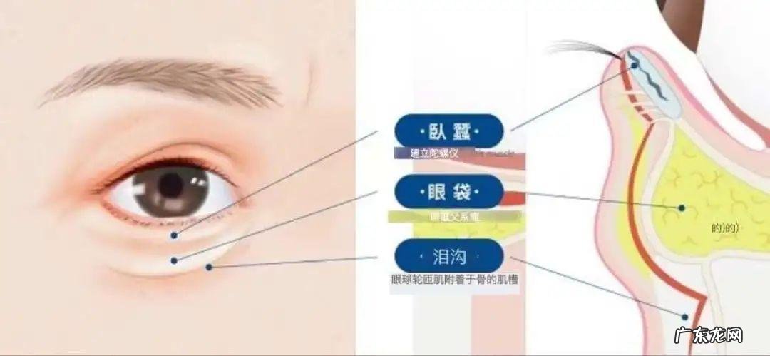 泪沟不难搞，选对方法就是“克星”