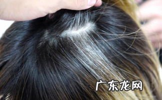 梦见白头发增多拔掉 梦见白头发是什么征兆 女人身体