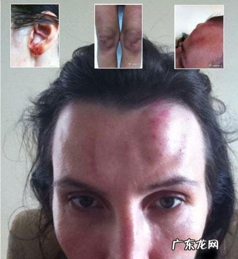 疯狂英语李阳家暴妻子案 疯狂英语李阳打老婆的事