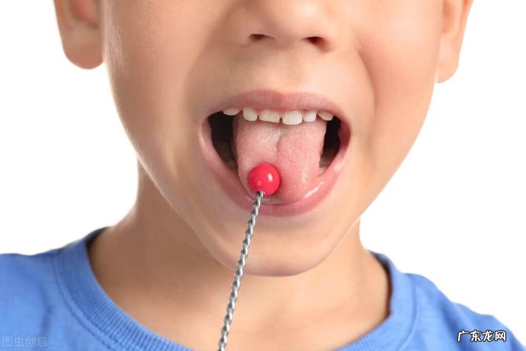 说话口吃怎么办 有点口吃怎么办