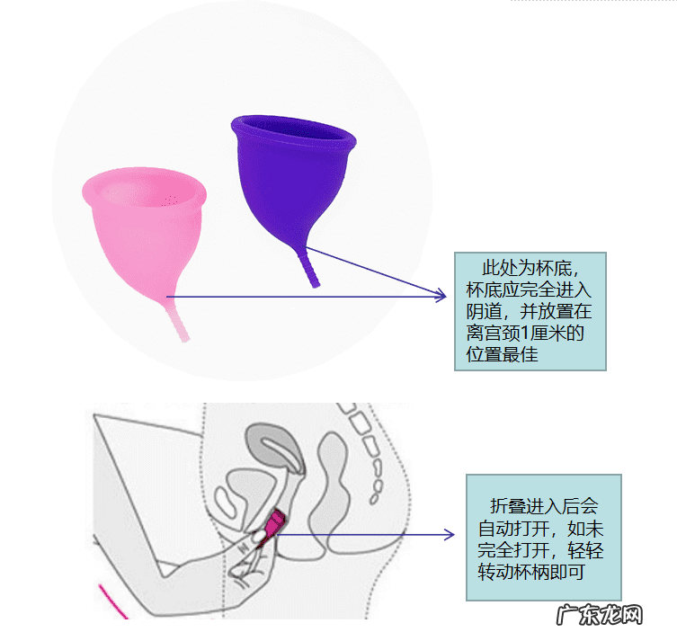 月亮杯戴上后的照片 月亮杯