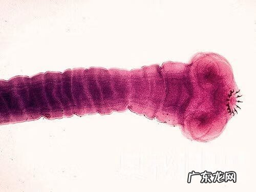 人体寄生虫图片 人体寄生虫有哪些