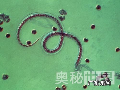 人体寄生虫图片 人体寄生虫有哪些