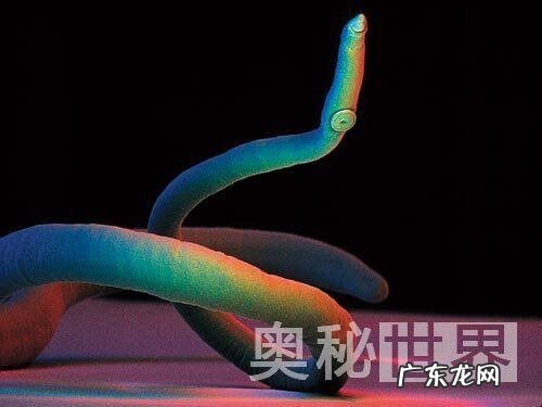 人体寄生虫图片 人体寄生虫有哪些