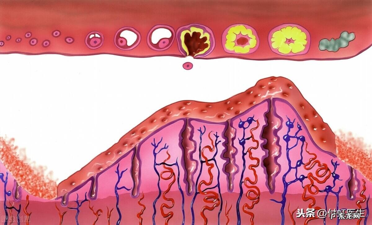 月经前出血是怎么回事 快要来月经前出血