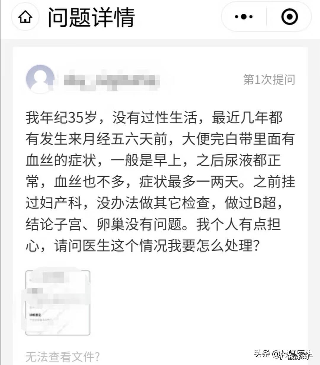 月经前出血是怎么回事 快要来月经前出血