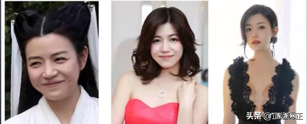 -本人圆脸，头发比较少，额头有比较大，目前是长直发，请问留什么样发型比较好看？