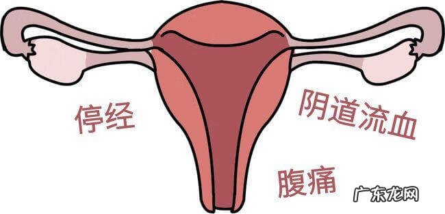 宫外怀孕可以生吗 如何排除宫外孕