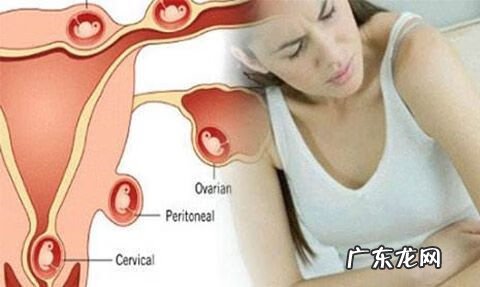 宫外怀孕可以生吗 如何排除宫外孕