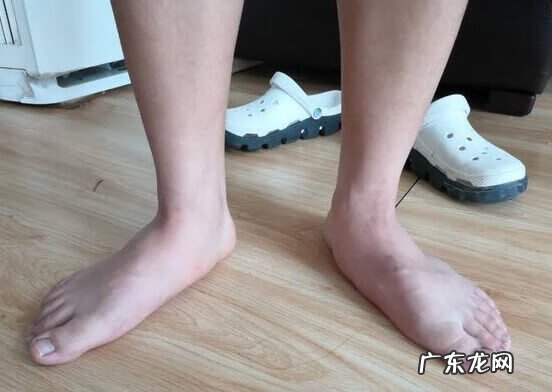 脚底板疼怎么办 脚底板疼是怎么回事什么原因