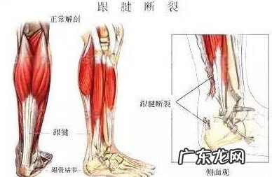 脚底板疼怎么办 脚底板疼是怎么回事什么原因