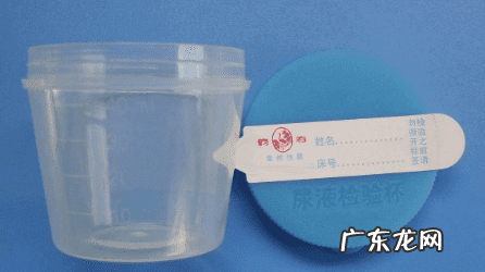 尿液rna检测多少钱 尿液检查一般多少钱