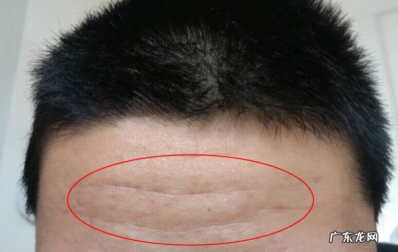 男人手掌纹路图解 男人脖子上有一圈纹路风水学