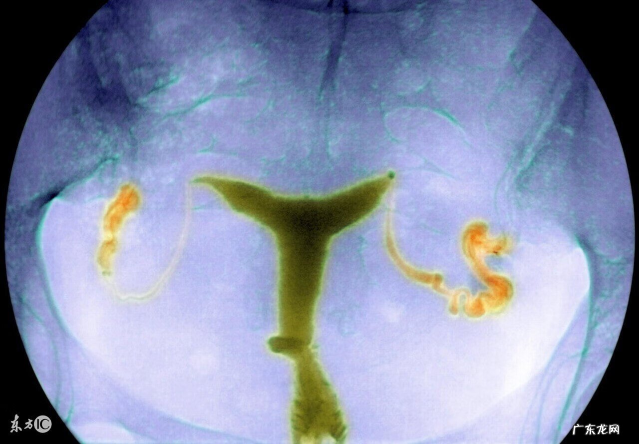 女生一直痛经的原因 女人痛经的原因?