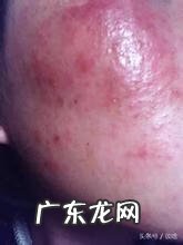 化妆品黑榜名单 微商化妆品黑名单希芸