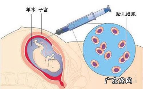 孕期能做亲子鉴定吗? 孕期亲子鉴定怎么做