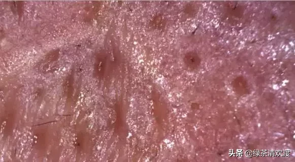 如何分辨你的皮肤类型?