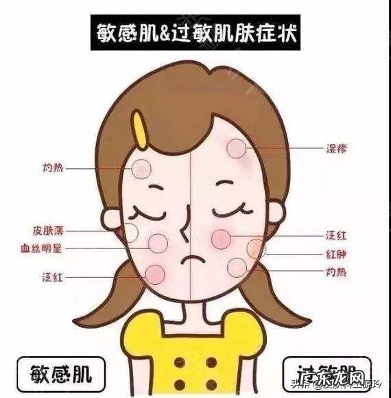 如何分辨你的皮肤类型?