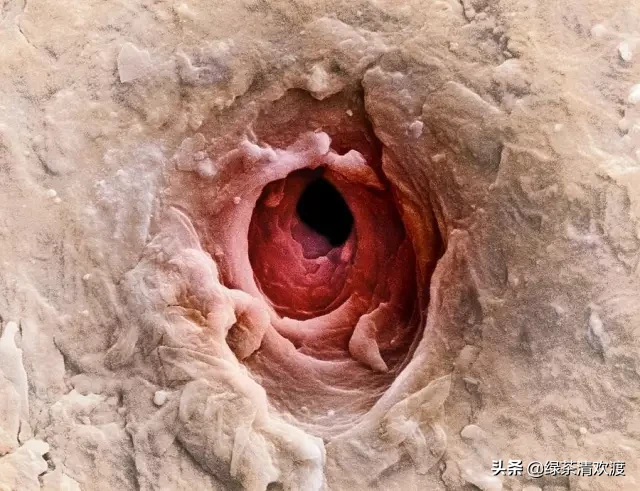 如何分辨你的皮肤类型?