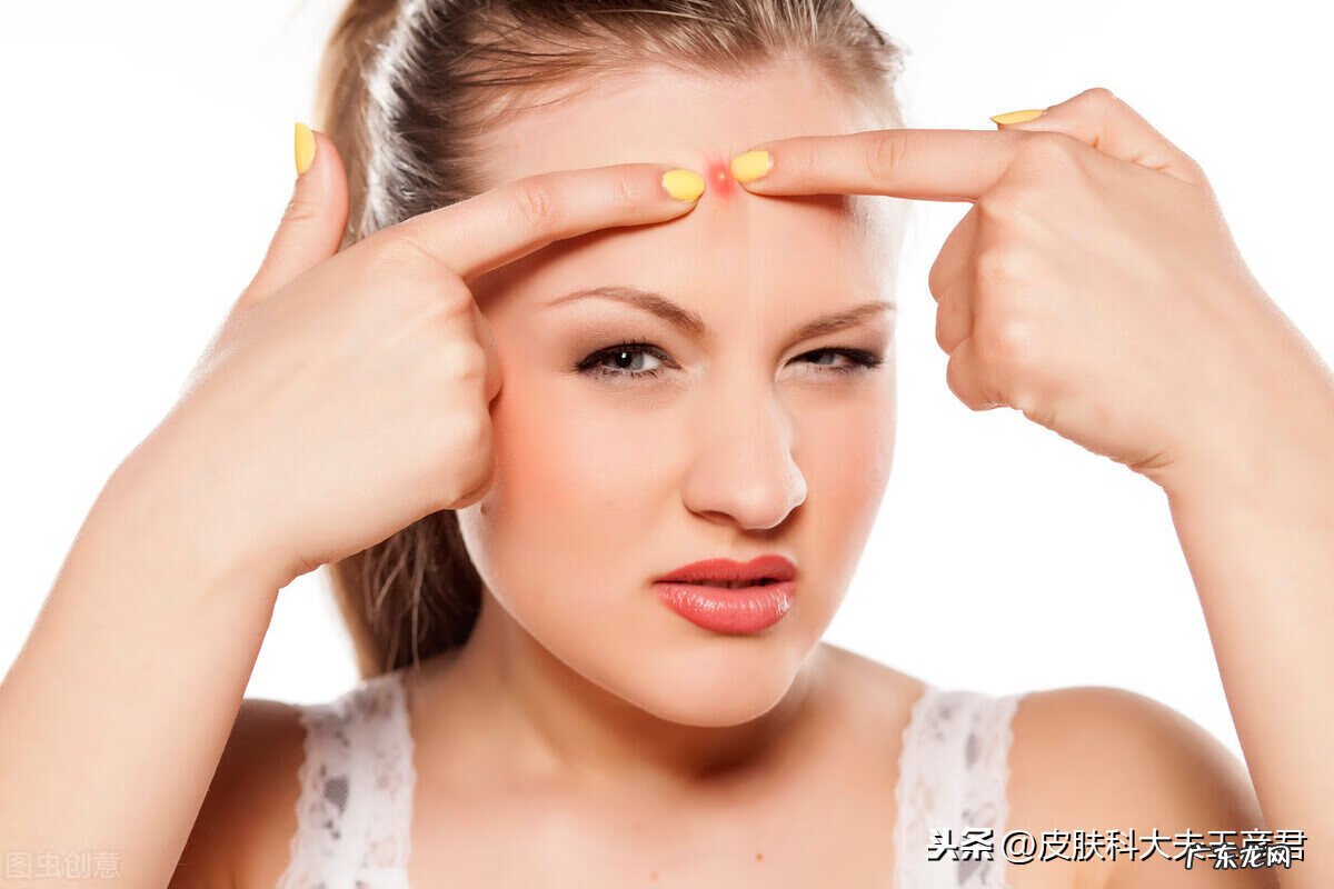 额头冒痘痘如何处理 额头起痘痘怎么办?