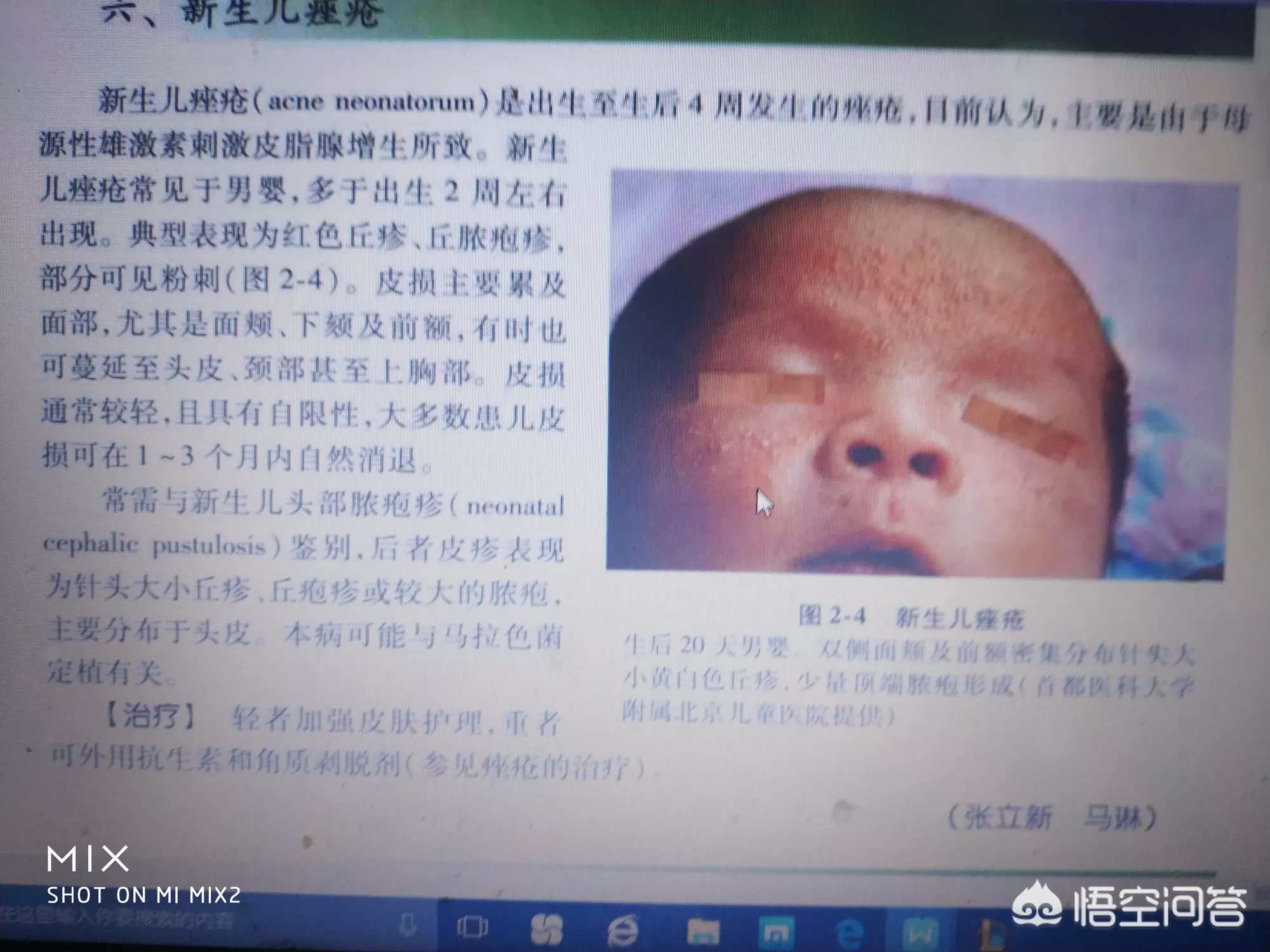 如何科学又正确的照顾初生宝宝?