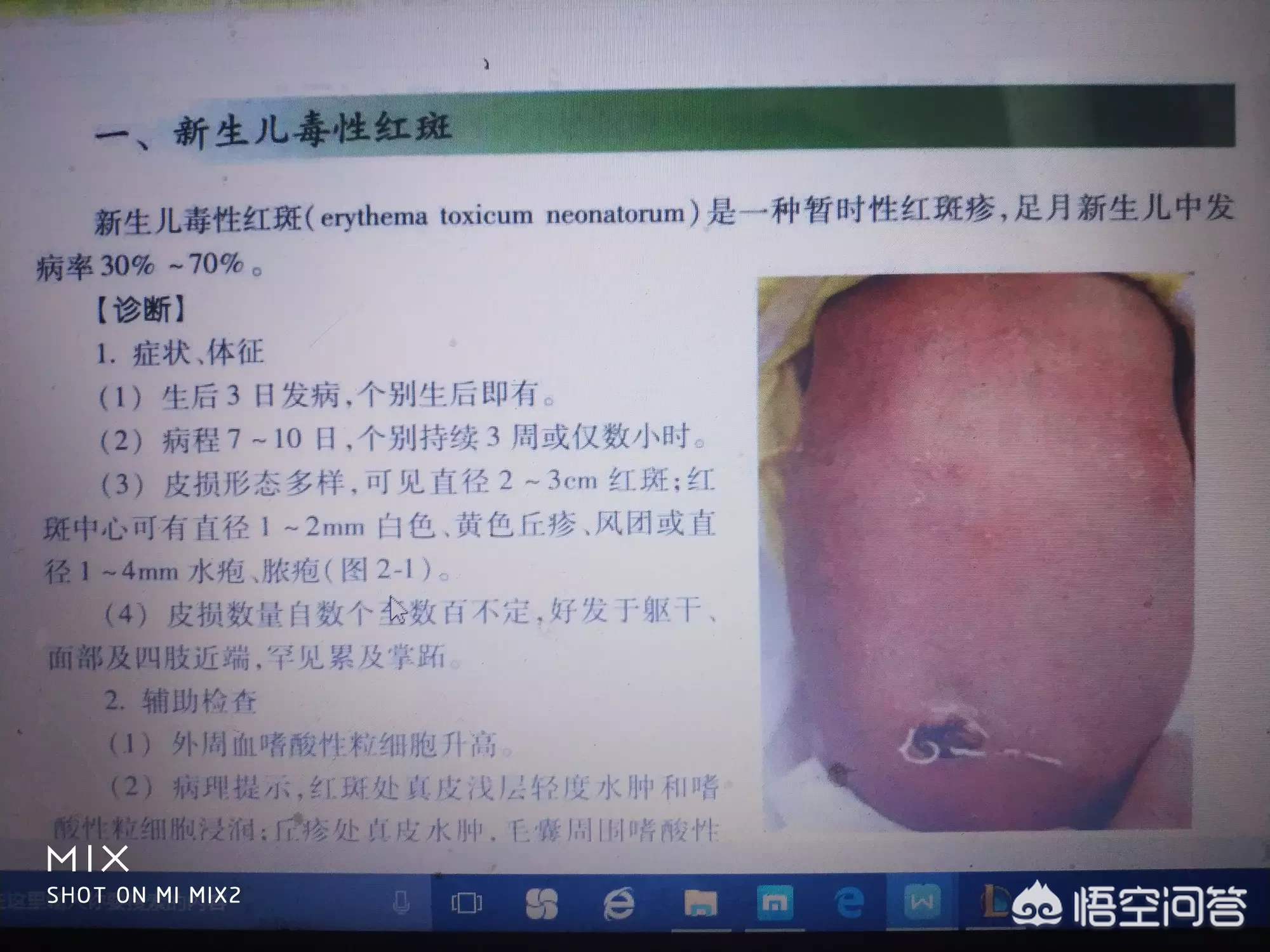 如何科学又正确的照顾初生宝宝?