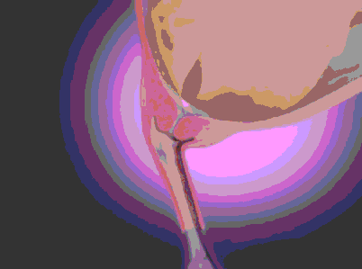 正常分娩的过程 女人分娩的过程