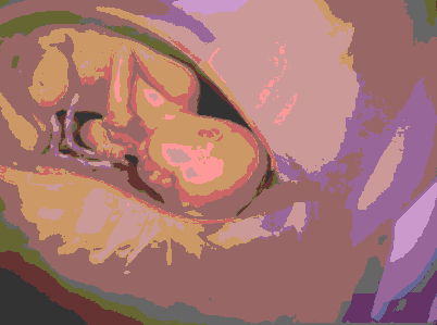 正常分娩的过程 女人分娩的过程