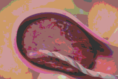 正常分娩的过程 女人分娩的过程