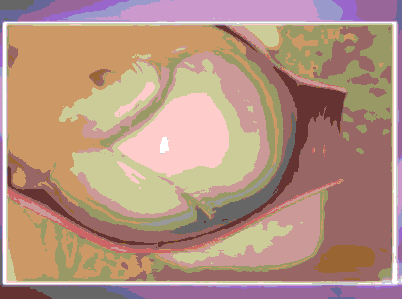 正常分娩的过程 女人分娩的过程