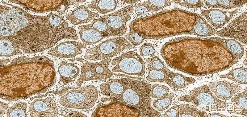 冬天怎样减肥最快最有效?