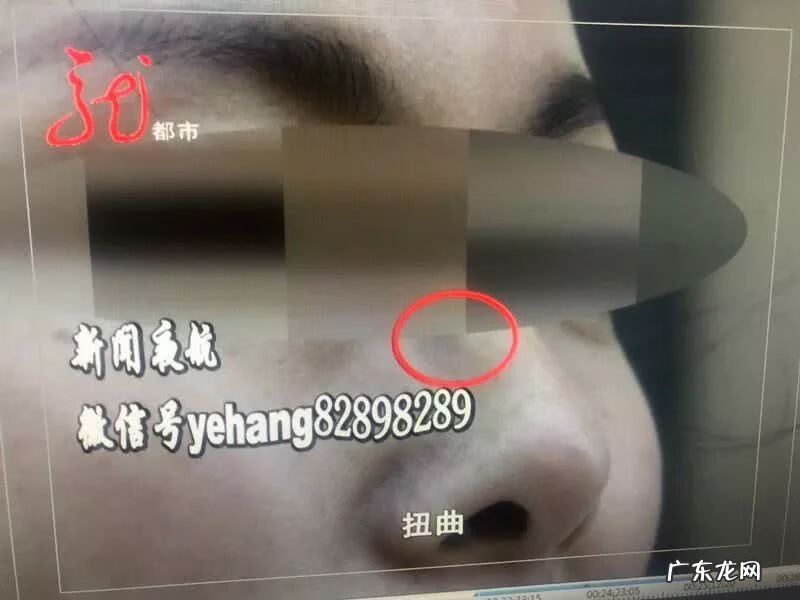 整容动了五官影响运气吗 风水整容多久起效果啊