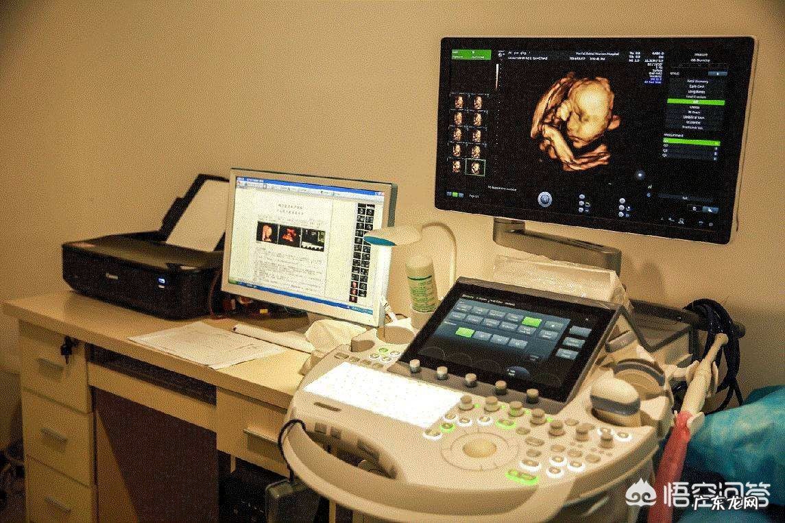 大排畸以后,为什么还要再做至少2次B超?真的重要吗?