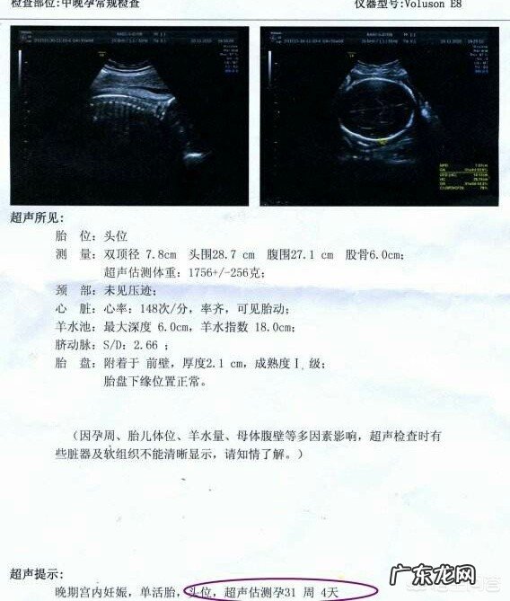 大排畸以后,为什么还要再做至少2次B超?真的重要吗?