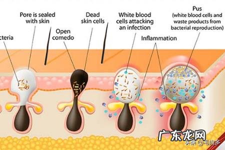 夏季护肤小知识?