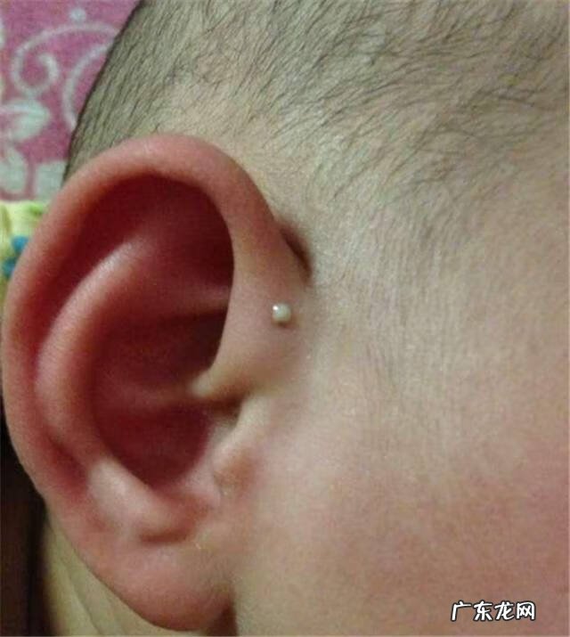 耳朵后面有两个小坑 耳朵上有小坑好不好