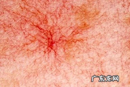 如何及早发现和预防肝病?