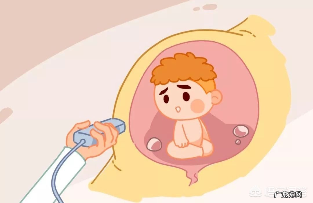 孕妇多久做一次b超检查呢？